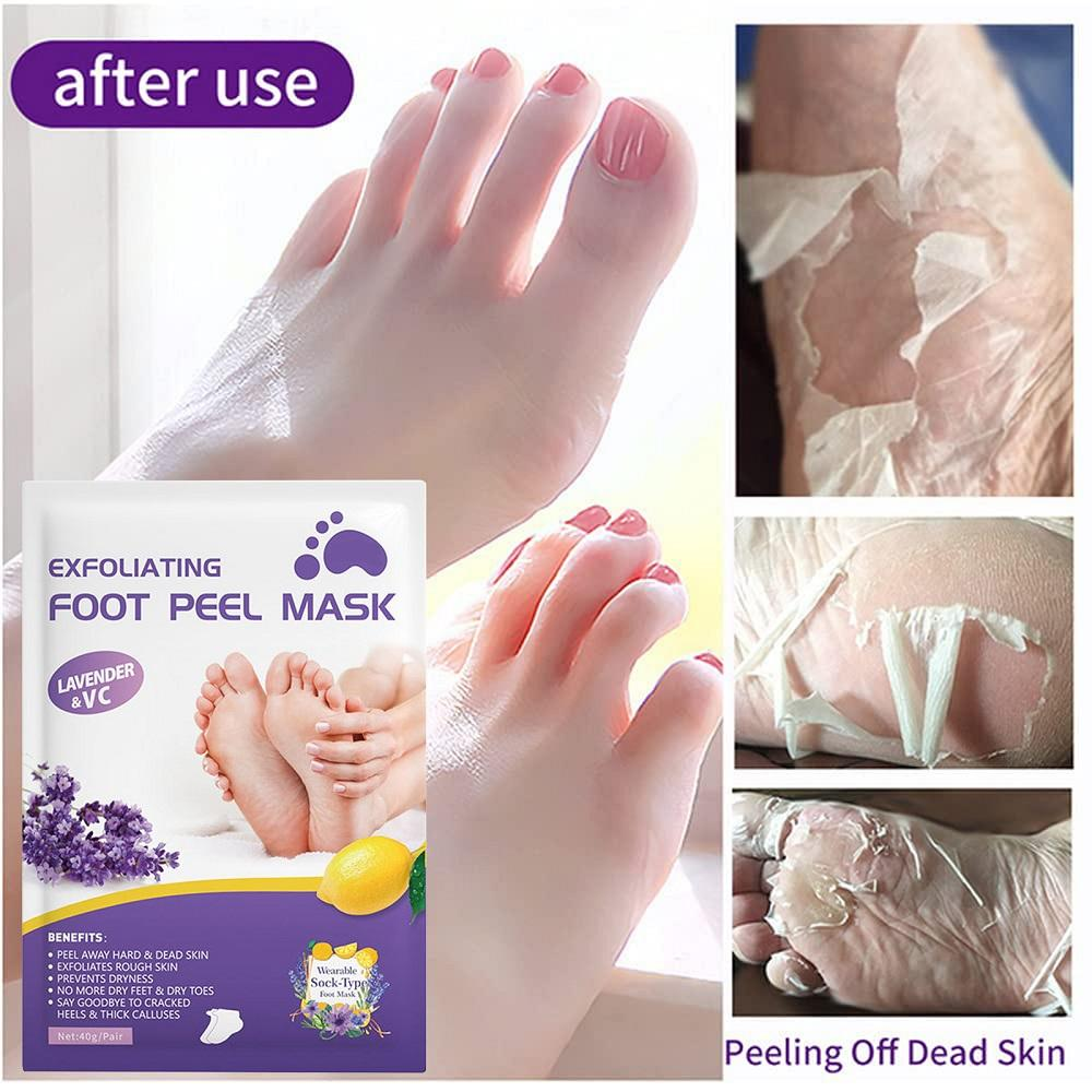 Viral Peeling Foot Mask (5 Pairs) – Get Baby Soft Feet in 7 Days!