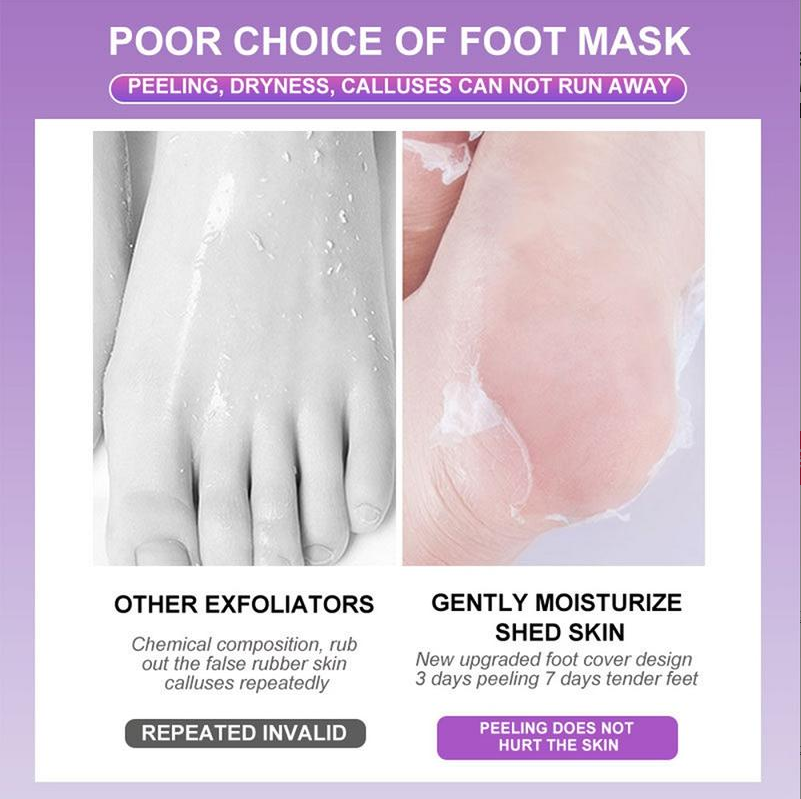 Viral Peeling Foot Mask (5 Pairs) – Get Baby Soft Feet in 7 Days!