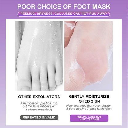 Lavender & Vitamin C Exfoliating Foot Peel Mask (5-Pack Bundle)