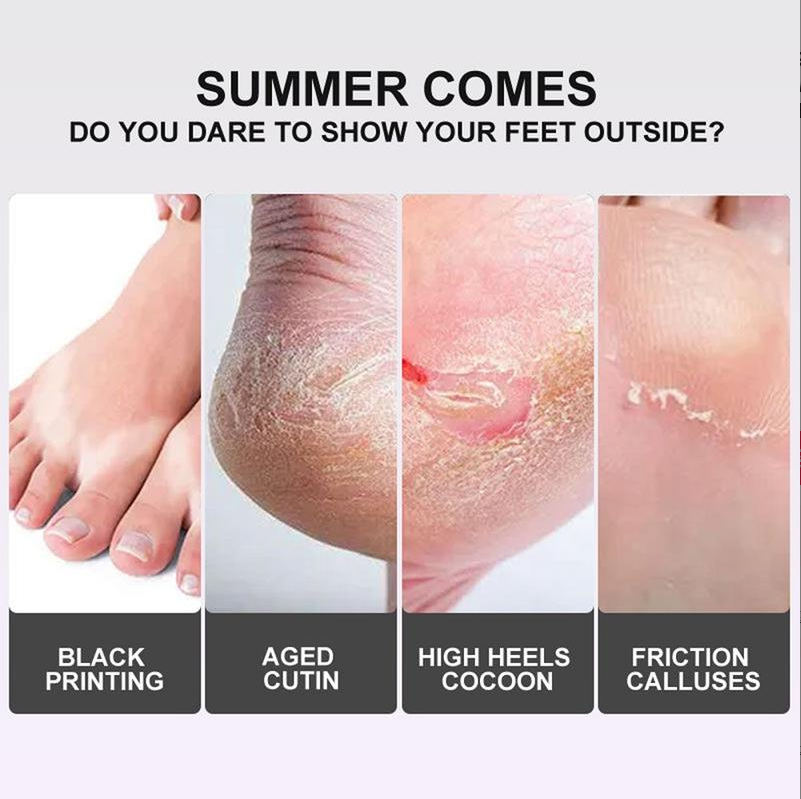 Viral Peeling Foot Mask (5 Pairs) – Get Baby Soft Feet in 7 Days!
